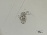 図鑑_nauplius of Copepoda